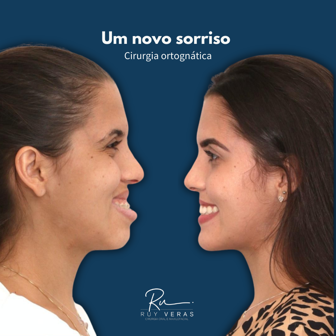 Imagem Primeira Sessão